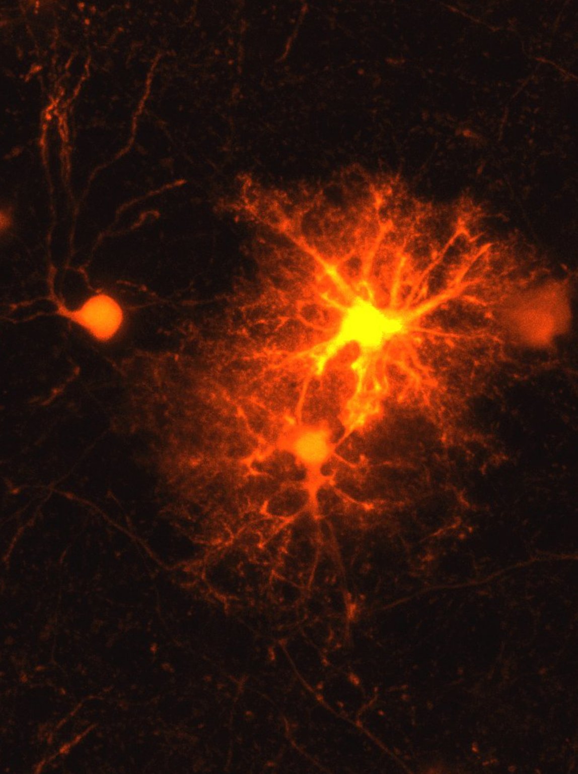 Brain Max System Stress hormone helps repair the brain - Max Planck Neuroscience